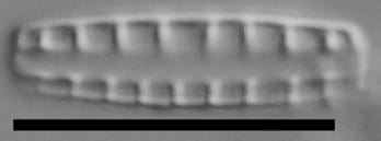 Denticula subtilis LM6