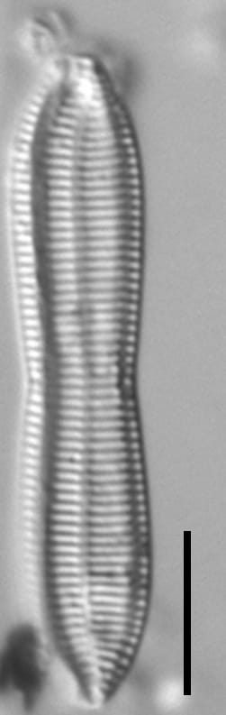 Tryblionella apiculata LM5