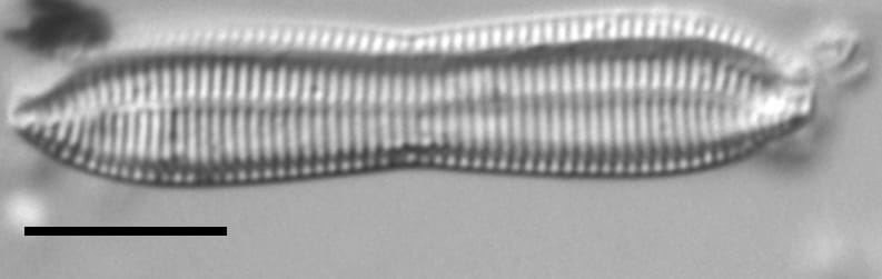 Tryblionella apiculata LM5