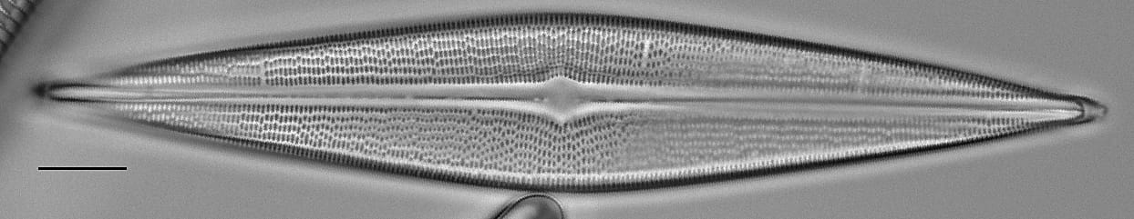 Brachysira serians LM5