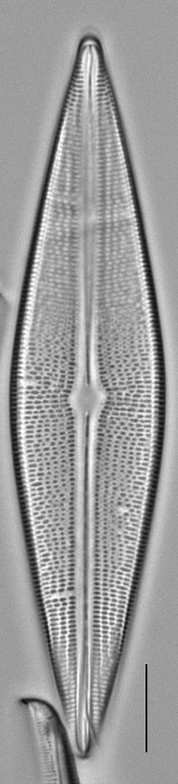 Brachysira serians LM3