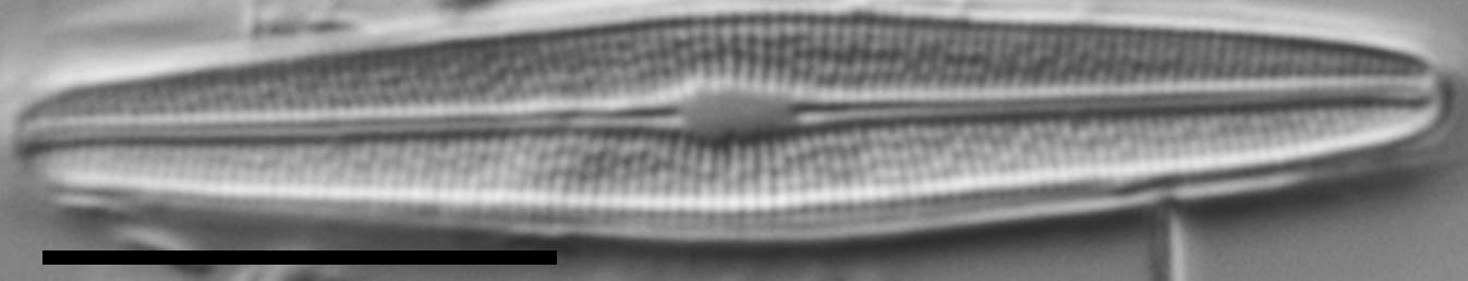 Brachysira subtile LM2