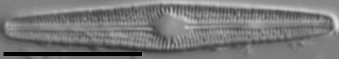 Brachysira subtile LM6