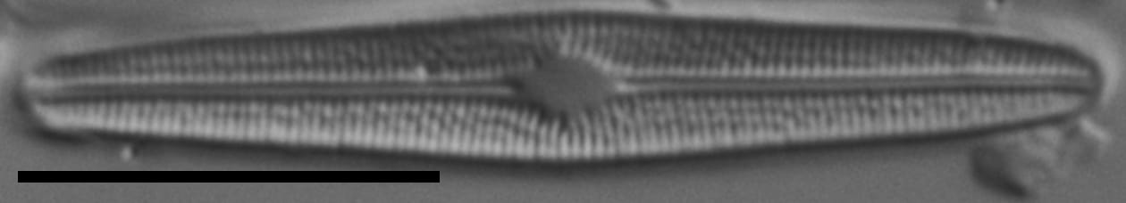 Brachysira subtile LM4