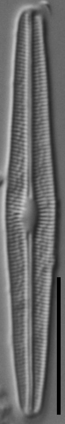 Brachysira subtile LM1