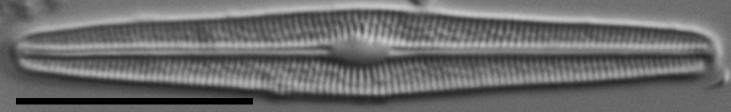 Brachysira subtile LM1