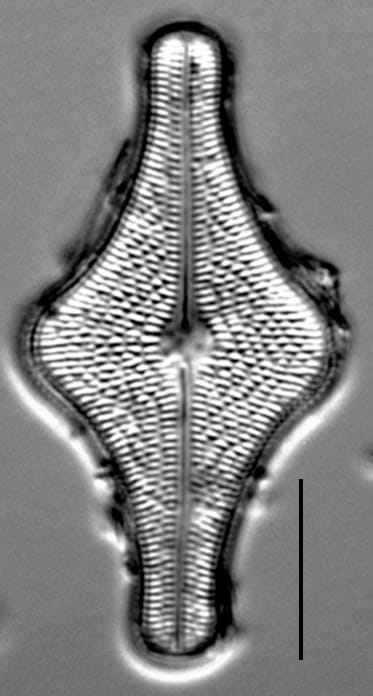 Brachysira follis LM6