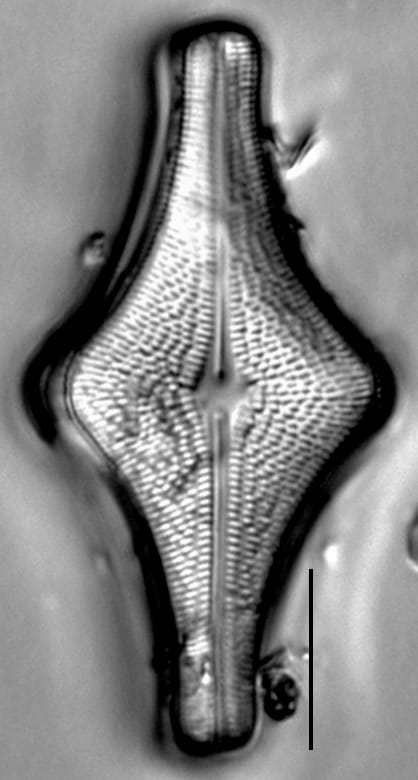 Brachysira follis LM3