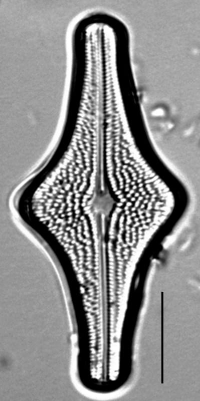 Brachysira follis LM2