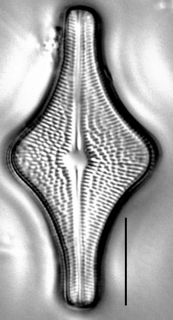 Brachysira follis LM7