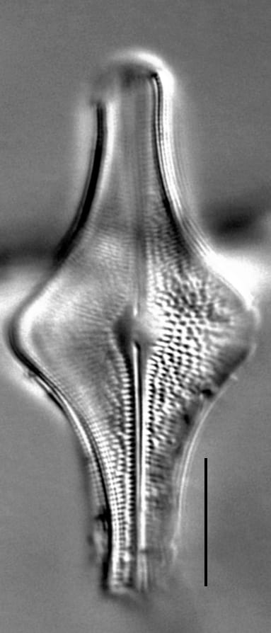 Brachysira follis LM1