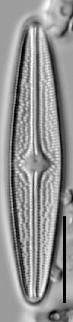 Brachysira confusa LM1