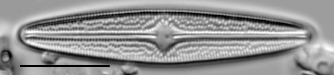 Brachysira confusa LM1