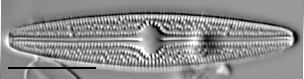 Brachysira confusa LM2