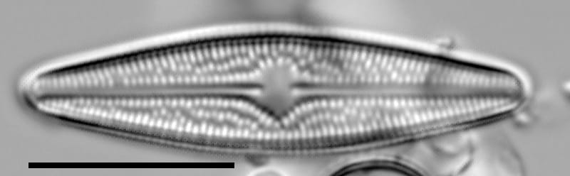 Brachysira confusa LM3