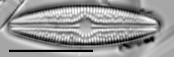 Brachysira confusa LM4