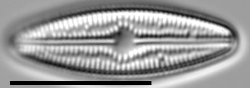 Brachysira confusa LM5