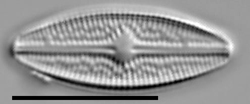 Brachysira confusa LM6