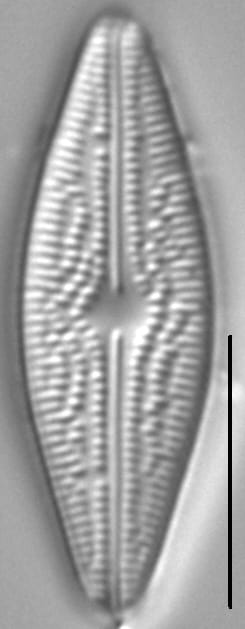 Brachysira arctoborealis LM6