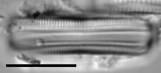 Brachysira confusa LM7