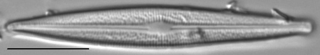 Brachysira ocalanensis LM1