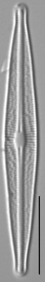 Brachysira ocalanensis LM3