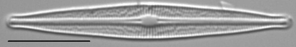 Brachysira ocalanensis LM3