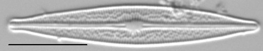 Brachysira ocalanensis LM4