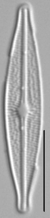 Brachysira ocalanensis LM5