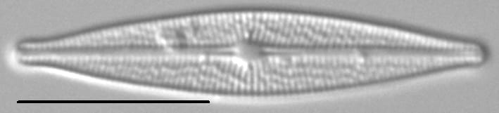 Brachysira ocalanensis LM7