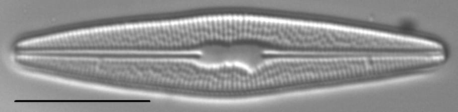 Brachysira styriaca LM1