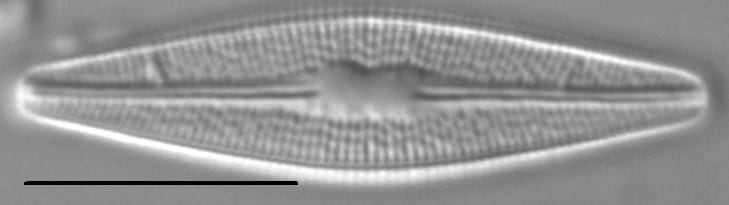Brachysira styriaca LM4
