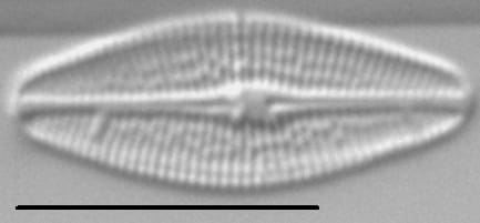 Brachysira styriaca LM7