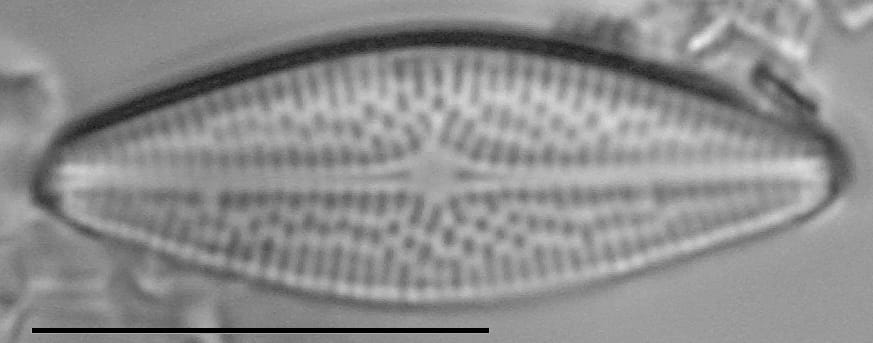 Brachysira brebissonii LM2