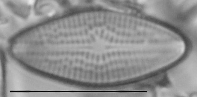 Brachysira brebissonii LM1