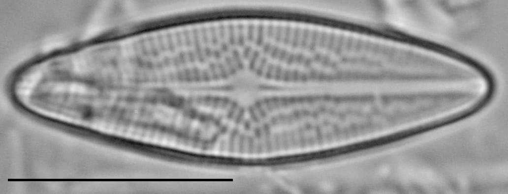 Brachysira brebissonii LM4