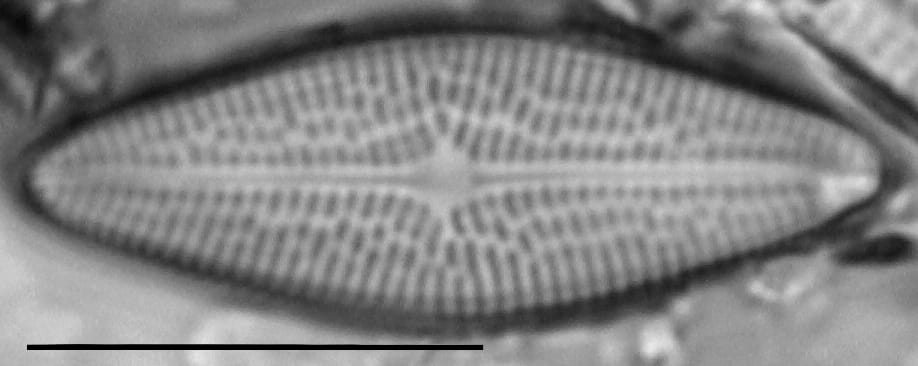 Brachysira brebissonii LM3