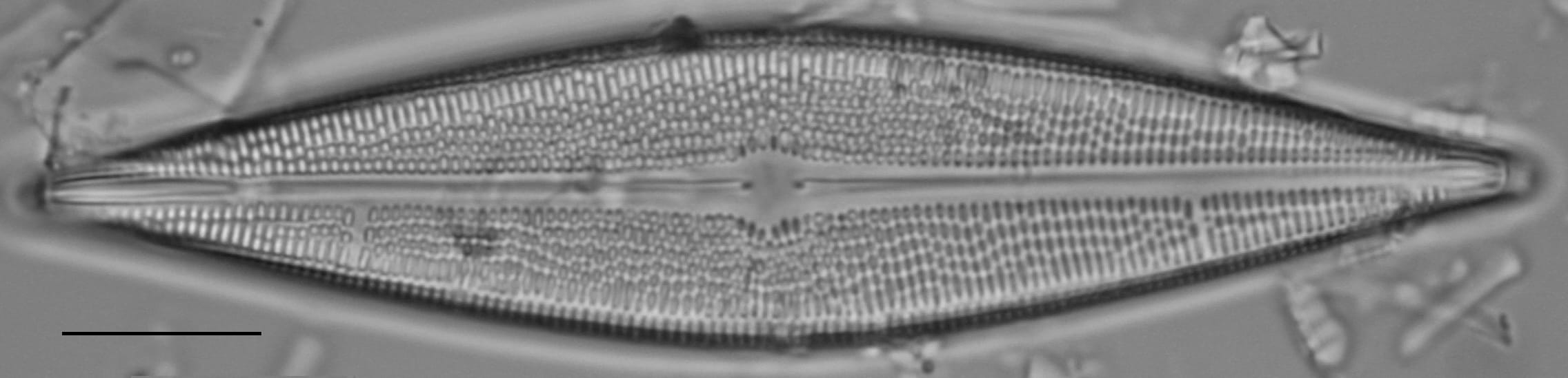 Brachysira serians LM2