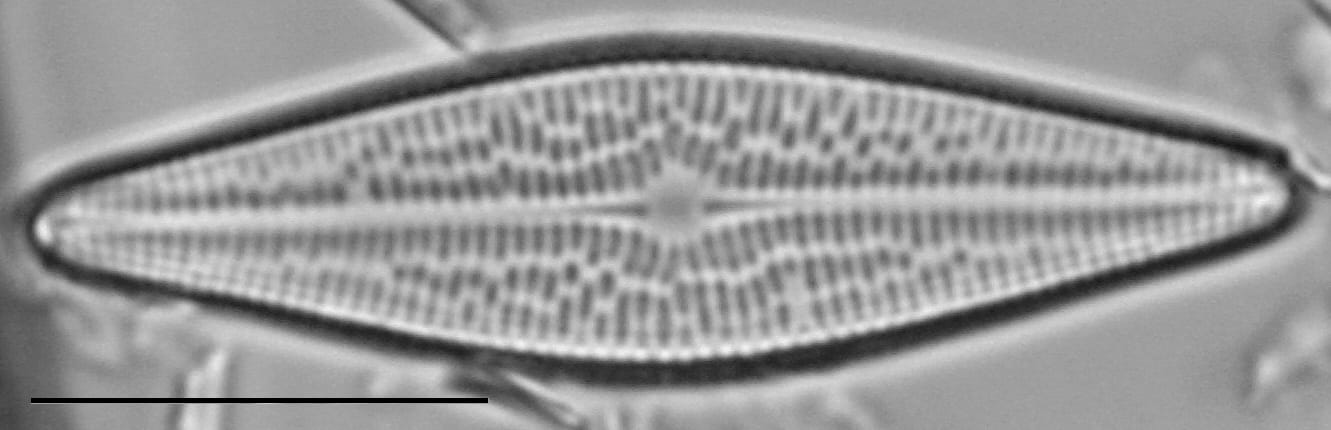 Brachysira brebissonii LM6