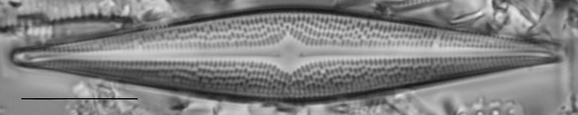 Bracysira neoacuta LM7