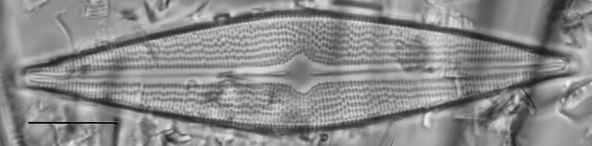 Brachysira serians LM1