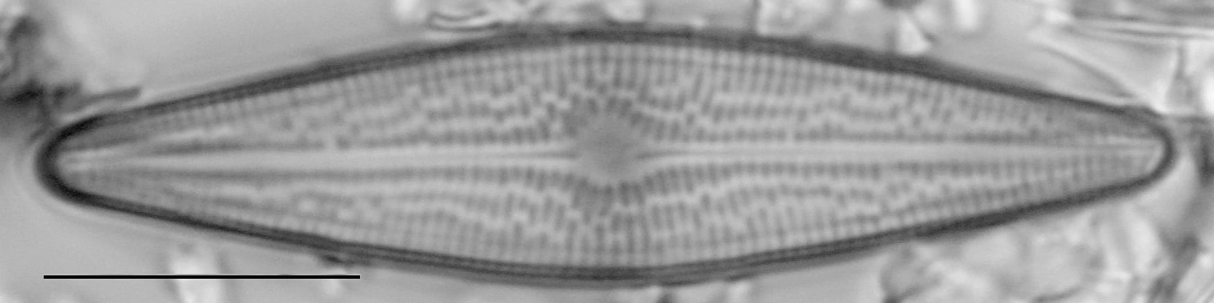 Brachysira brebissonii LM7