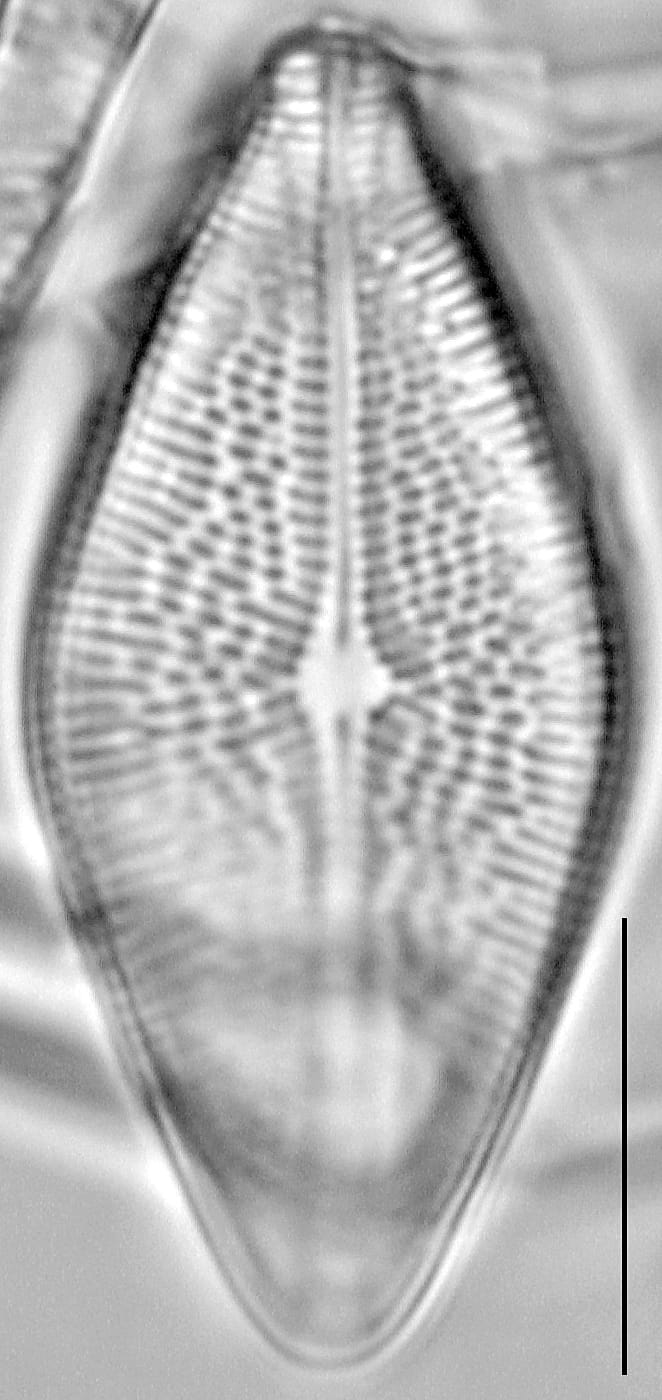 Brachysira hannae LM4