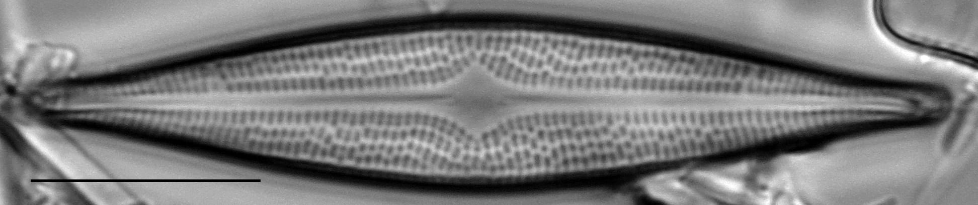 Bracysira neoacuta LM5