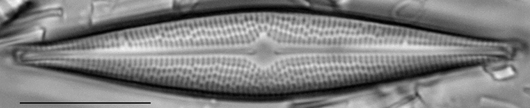 Bracysira neoacuta LM3