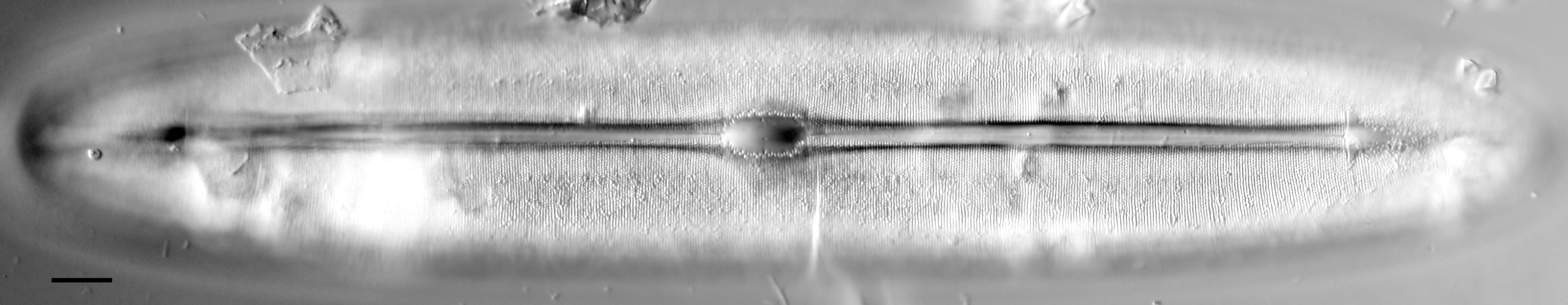 Frickea lewisiana LM3