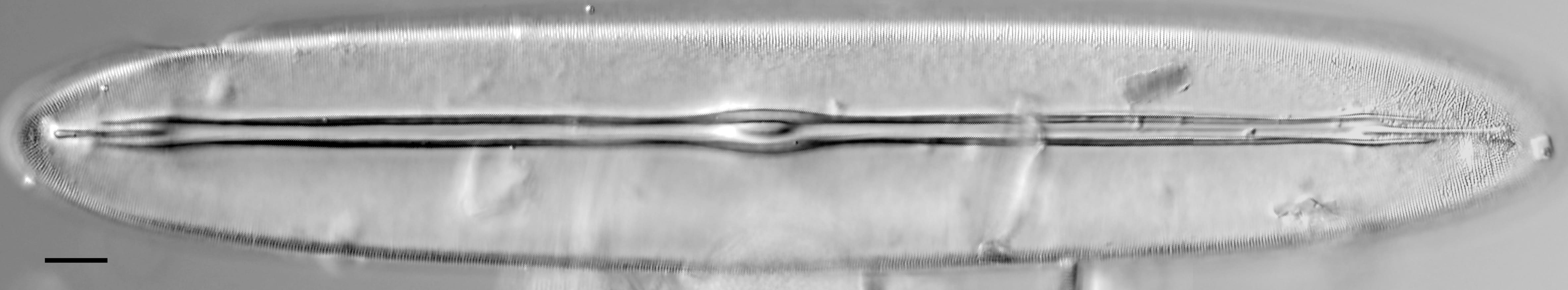 Frickea lewisiana LM2