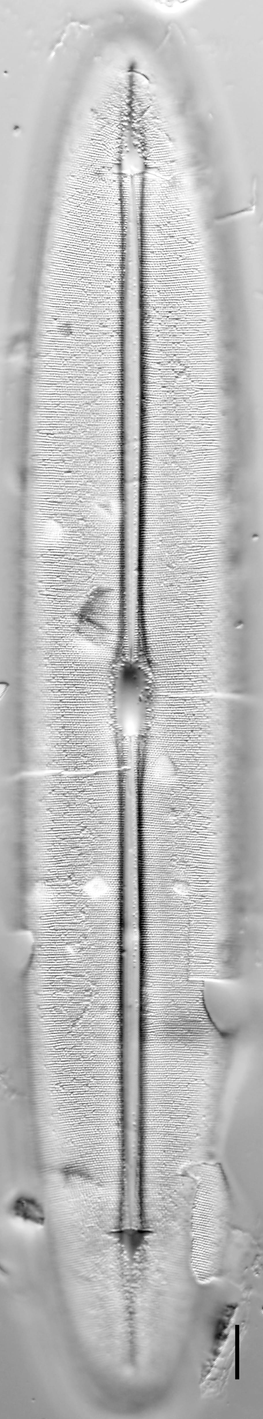 Frickea lewisiana LM1