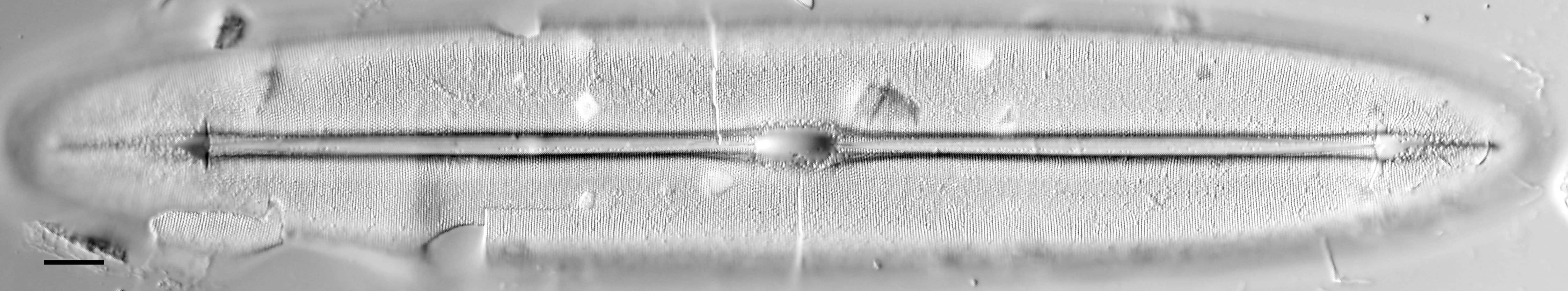 Frickea lewisiana LM1