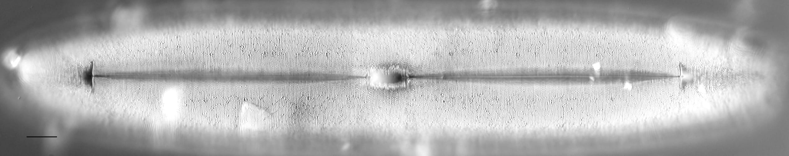 Frickea lewisiana LM5